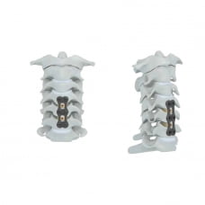 Hệ thống Nẹp vít cột sống cổ lối trước  Anterior cervical plate system 